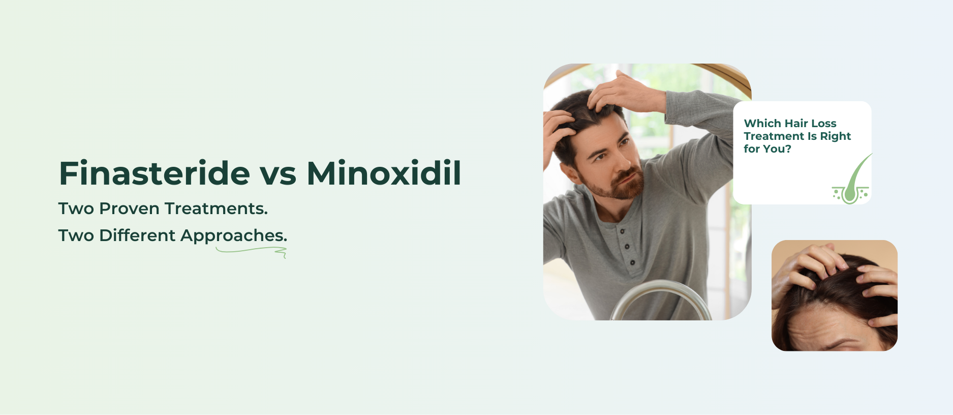 Finasteride vs Minoxidil: Which Hair Loss Treatment Is Right for You?